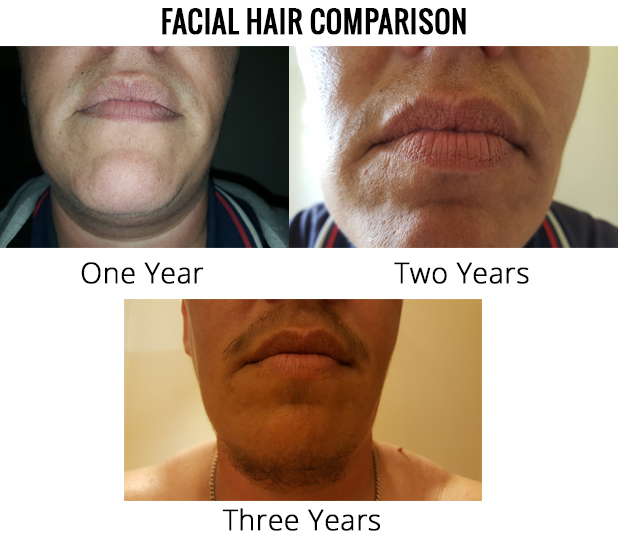 three year facial hair comparison
