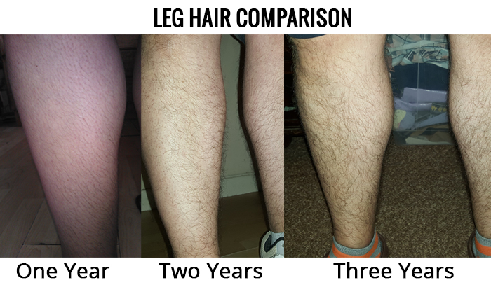 three year leg hair comparison