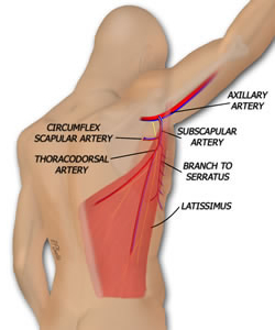 mld donor site